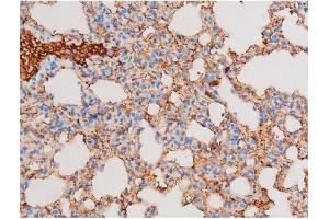 Immunohistochemistry (IHC) image for anti-Protein Kinase C, theta (PRKCQ) (pSer676) antibody (ABIN6256401)