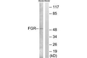 Western blot analysis of extracts from RAW264. (Fgr 抗体  (AA 381-430))