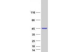 Western Blotting (WB) image for Prostaglandin Reductase 2 (PTGR2) (Transcript Variant 2) protein (Myc-DYKDDDDK Tag) (ABIN2735750)