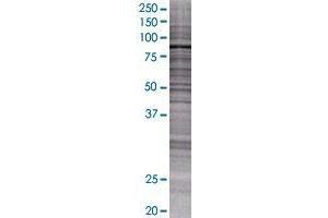 CCDC8 transfected lysate. (CCDC8 293T Cell Transient Overexpression Lysate(Denatured))