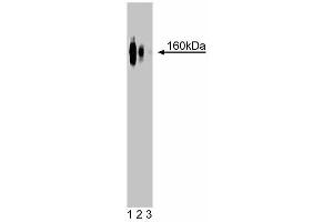 Western blot analysis of delta-Catenin on rat brain lysate. (CTNND2 抗体  (AA 85-194))