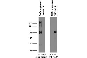 anti-Germ Cell Associated 2 (Haspin) (GSG2) (AA 1-798) antibody