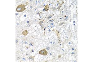 Immunohistochemistry of paraffin-embedded rat brain using IFNL3 antibody at dilution of 1:100 (40x lens). (IL28B 抗体)