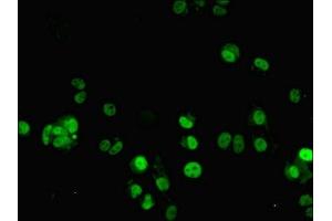 Immunofluorescent analysis of MCF-7 cells using ABIN7176421 at dilution of 1:100 and Alexa Fluor 488-congugated AffiniPure Goat Anti-Rabbit IgG(H+L) (ZNF596 抗体  (AA 201-504))