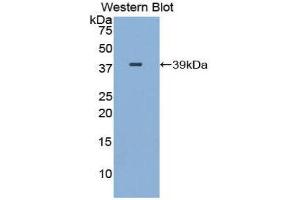 Western Blotting (WB) image for anti-gamma Lipotropin (AA 179-234) antibody (ABIN1859027) (gamma Lipotropin (AA 179-234) 抗体)