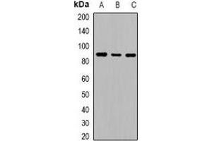 Western blot analysis of Cadherin 20 expression in HeLa (A), mouse liver (B), rat liver (C) whole cell lysates. (Cadherin 20 抗体)