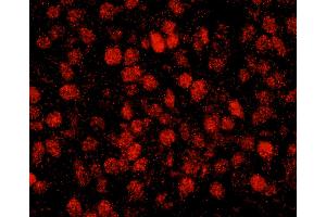 Immunofluorescence (IF) image for anti-REST Corepressor 3 (RCOR3) (AA 445-495) antibody (ABIN7449047)