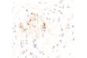Immunohistochemical analysis of LEMD3 in human colon tissue with LEMD3 polyclonal antibody  at 2. (LEMD3 抗体  (C-Term))