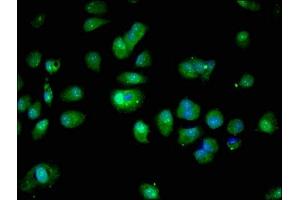 Immunofluorescent analysis of MCF-7 cells using ABIN7166049 at dilution of 1:100 and Alexa Fluor 488-congugated AffiniPure Goat Anti-Rabbit IgG(H+L) (S1A16 (AA 1-103) 抗体)