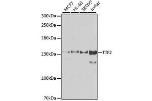 Western blot analysis of extracts of various cell lines, using TTF2 antibody. (TTF2 抗体  (AA 1-270))