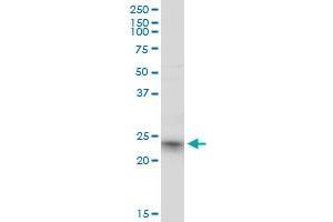 RRAS2 monoclonal antibody (M01), clone 2D3-4B8. (RRAS2 抗体  (AA 1-204))