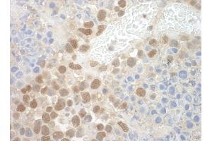 Immunohistochemistry (IHC) image for anti-Pogo Transposable Element with ZNF Domain (POGZ) (AA 1360-1410) antibody (ABIN7448730)