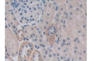 Detection of CENTa2 in Rat Kidney Tissue using Polyclonal Antibody to Centaurin Alpha 2 (CENTa2)