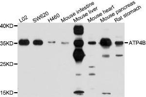 Western blot analysis of extracts of various cells, using ATP4B antibody. (ATP4b 抗体)