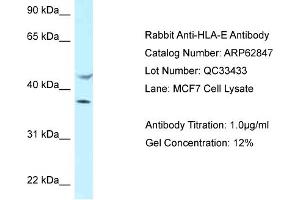 Western Blotting (WB) image for anti-HLA Class I Histocompatibility Antigen, alpha Chain E (HLA-E) (C-Term) antibody (ABIN2789266) (HLA-E 抗体  (C-Term))