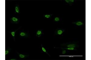 Immunofluorescence of monoclonal antibody to PAX8 on HeLa cell. (PAX8 抗体  (AA 141-250))