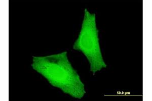 Immunofluorescence of monoclonal antibody to MAF on HeLa cell. (MAF 抗体  (AA 304-403))