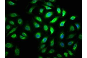 Immunofluorescence (IF) image for anti-Myosin VA (MYO5A) (AA 1087-1220) antibody (ABIN7174953)