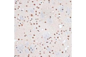 Immunohistochemistry of paraffin-embedded mouse brain using RBM3 antibody  at dilution of 1:100 (40x lens). (RBM3 抗体  (AA 1-157))