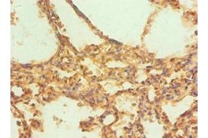 Immunohistochemistry of paraffin-embedded human lung tissue using ABIN7146530 at dilution of 1:100 (CAPNL1 抗体  (Catalytic Subunit))