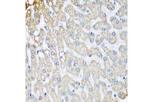 Immunohistochemistry (Paraffin-embedded Sections) (IHC (p)) image for anti-Cytochrome C Oxidase Subunit Vb (COX5B) (AA 32-129) antibody (ABIN3016356)