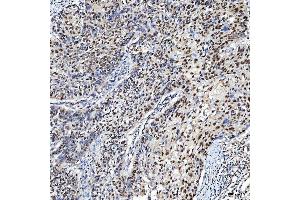 IHC analysis of SF3A3 using anti-SF3A3 antibody (ABIN7599863).