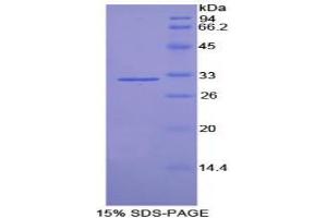 SDS-PAGE analysis of Rat Tubulin delta Protein. (TUBD1 蛋白)