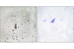 Immunohistochemistry (IHC) image for anti-Potassium Inwardly-Rectifying Channel, Subfamily J, Member 1 (KCNJ1) (AA 11-60), (pSer44) antibody (ABIN1531698)