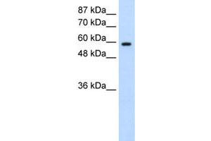 Western Blot analysis of Daudi cell lysate with DAZ2 polyclonal antibody  at 0.