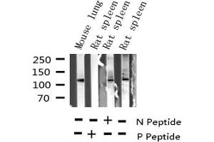 Western blot analysis of Phospho-JAK2 (Tyr221) expression in various lysates (JAK2 抗体  (pTyr221))