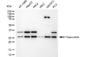 Western blotting analysis using hippocalcin antibody (ABIN7798912). (Recombinant Hippocalcin 抗体)