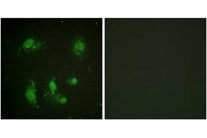 Immunofluorescence analysis of HeLa cells, using Survivin (Ab-117) Antibody. (Survivin 抗体  (AA 86-135))