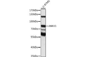 Western blot analysis of extracts of U-87MG cells, using  antibody (ABIN7265605) at 1:1000 dilution.