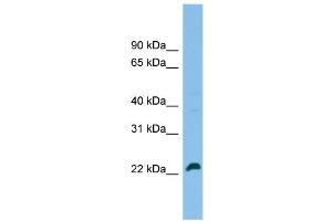 WB Suggested Anti-SPATA24 Antibody Titration: 0. (SPATA24 抗体  (C-Term))
