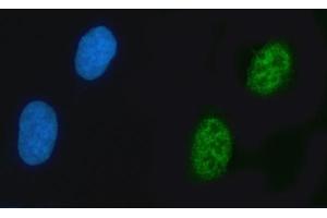 IF analysis of ZNF609 using anti-ZNF609 antibody (ABIN7602578).