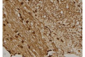 ABIN6273461 at 1/100 staining Mouse brain tissue by IHC-P. (CENPM 抗体  (Internal Region))