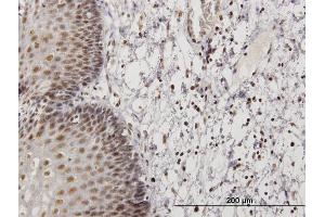 Immunoperoxidase of  purified  MaxPab antibody to RNF32 on formalin-fixed paraffin-embedded human esophagus. (RNF32 抗体  (AA 1-256))