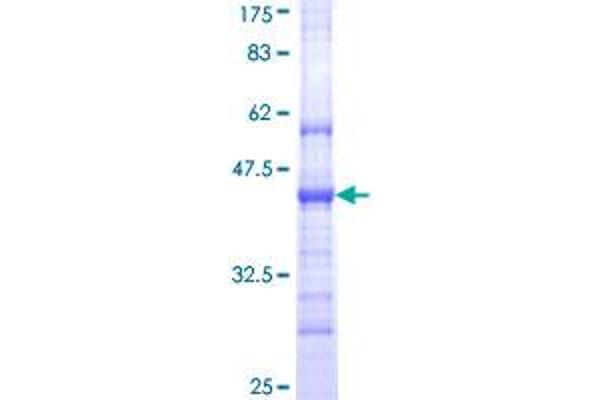 CDHR5 Protein (AA 27-125) (GST tag)