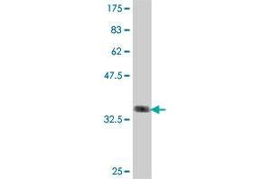 Western Blot detection against Immunogen (36. (PRP19 抗体  (AA 1-90))