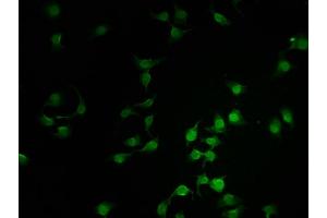 Immunofluorescence (IF) image for anti-SWI/SNF Related, Matrix Associated, Actin Dependent Regulator of Chromatin, Subfamily C, Member 2 (SMARCC2) (AA 300-650) antibody (ABIN7171058)
