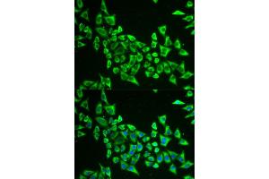 Immunofluorescence analysis of HeLa cell using MRPS30 antibody. (MRPS30 抗体)