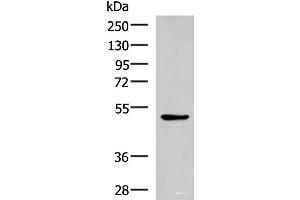 Western blot analysis of LOVO cell lysate using BLNK Polyclonal Antibody at dilution of 1:600 (B-Cell Linker 抗体)