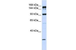 ABCA5 antibody used at 1 ug/ml to detect target protein. (ABCA5 抗体)