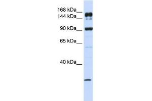 ABCA5 antibody used at 1 ug/ml to detect target protein.