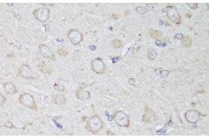Immunohistochemistry of paraffin-embedded Rat brain using GANAB Polyclonal Antibody at dilution of 1:150 (40x lens). (GANAB 抗体)