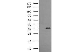 Western Blotting (WB) image for anti-T-cell surface glycoprotein CD1c (CD1C) antibody (ABIN2670671) (CD1c 抗体)