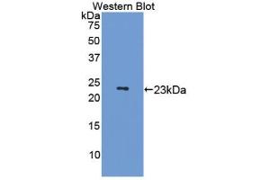 Western blot analysis of the recombinant protein. (MAP4 抗体  (AA 882-1062))