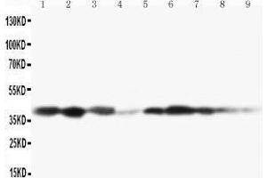 Lane 9: COLO320 Cell Lysate (MAP2K3 抗体  (C-Term))