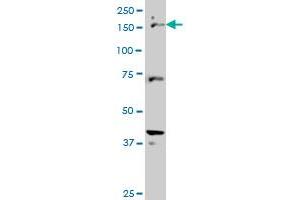CUTL1 monoclonal antibody (M02), clone 2D10 Western Blot analysis of CUTL1 expression in Hela S3 NE . (CUX1 抗体  (AA 521-620))