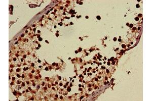 Immunohistochemistry (IHC) image for anti-DEAD (Asp-Glu-Ala-Asp) Box Polypeptide 39B (DDX39B) (AA 2-251) antibody (ABIN7170614)
